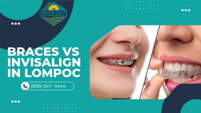 Braces vs Invisalign in Lompoc